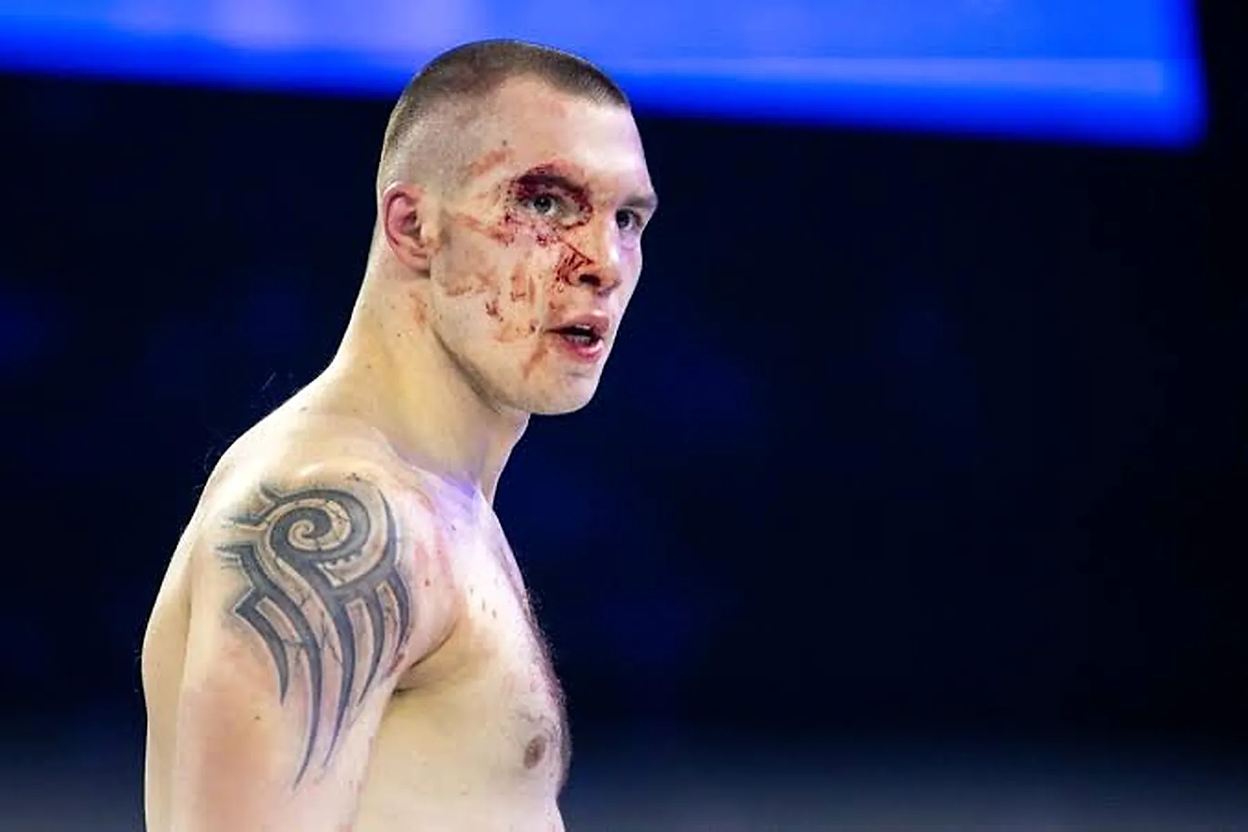 IGNAS — MMA KOVA